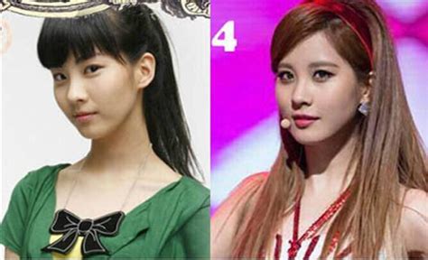onehallyu plastic surgery.
